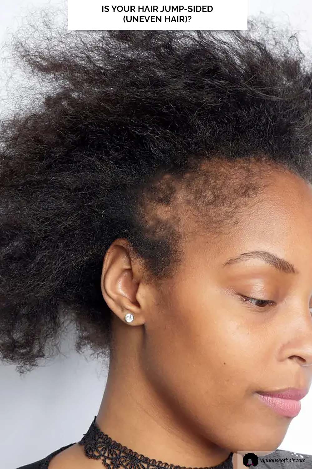 Is Your Hair Jump-Sided (Uneven Hair)?